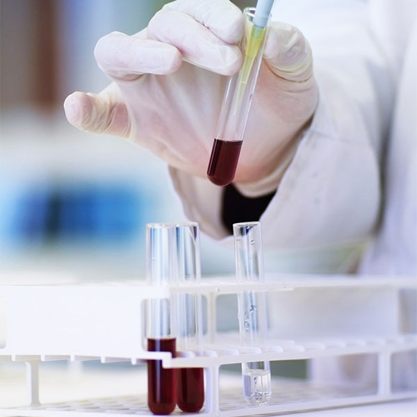 ӡWestern blot
